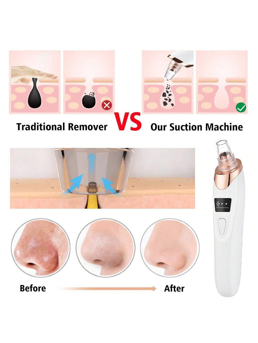 Electric Blackhead Remover Pore Vacuum Acne Cleanser